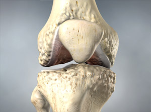 omaha knee arthritis